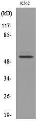 Western blot analysis of lysate from K562 cells using Anti-PROC Antibody