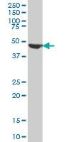 Anti-FH Mouse Monoclonal Antibody [clone: 5C12]