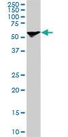 Anti-STIP1 Mouse Monoclonal Antibody [clone: 1E3]