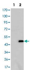 Anti-ATXN1 Mouse Monoclonal Antibody [clone: 2F5]