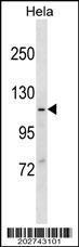 Anti-MVP Mouse Monoclonal Antibody [clone: 599CT2.4.1]