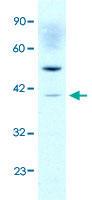 Anti-ACAT2 Rabbit Polyclonal Antibody