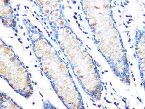 Immunohistochemistry analysis of paraffin-embedded human colon tissue using Anti-MUC2 Antibody [ARC1012] (A308122) at a dilution of 1:100 (40x lens). Perform microwave antigen retrieval with 10 mM PBS buffer pH 7.2 before commencing with IHC staining protocol