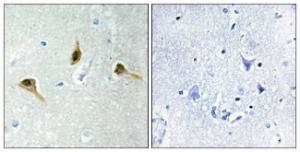 Immunohistochemical analysis of paraffin-embedded human brain tissue using Anti-MSH2 Antibody. The right hand panel represents a negative control, where the antibody was pre-incubated with the immunising peptide.