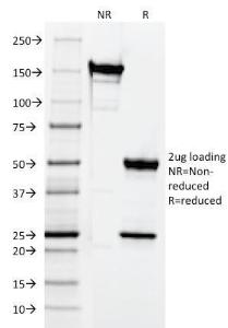 SDS-PAGE analysis of Anti-CD3 epsilon Antibody [CRIS-7] under non-reduced and reduced conditions; showing intact IgG and intact heavy and light chains, respectively. SDS-PAGE analysis confirms the integrity and purity of the Antibody