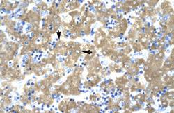 Anti-ACAT2 Rabbit Polyclonal Antibody