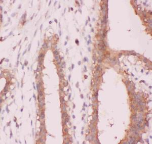 Anti-NFkB p100/p52 Polyclonal Antibody