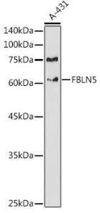 Western blot analysis of extracts of A-431 cells, using Anti-Fibulin 5 Antibody (A12432) at 1:1000 dilution. The secondary Antibody was Goat Anti-Rabbit IgG H&L Antibody (HRP) at 1:10000 dilution. Lysates/proteins were present at 25 µg per lane