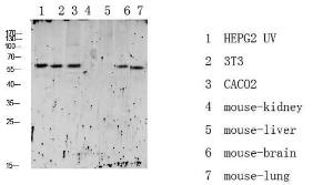 Western blot analysis of various lysate using Anti-RIPK2 (phospho Ser176) Antibody