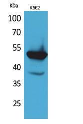 Western blot analysis of K562 cells using Anti-PROC Antibody