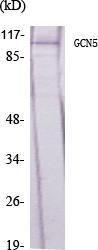 Anti-GCN5L2 antibody