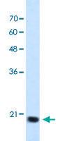 Anti-SSR2 Rabbit Polyclonal Antibody