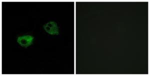 Immunofluorescence analysis of HepG2 cells using Anti-MTR1A Antibody. The right hand panel represents a negative control, where the antibody was pre-incubated with the immunising peptide