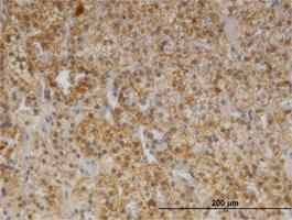 Anti-CDR2 Mouse Monoclonal Antibody [clone: 1F8]