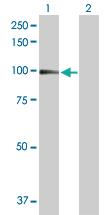 Anti-ITGB2 Rabbit Polyclonal Antibody