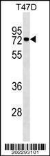 Anti-MX1 Mouse Monoclonal Antibody [clone: 474CT4.1.5]