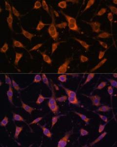 Immunofluorescence analysis of L929 cells using Anti-Fibulin 5 Antibody (A12432) at a dilution of 1:100 (40X lens). DAPI was used to stain the cell nuclei (blue)