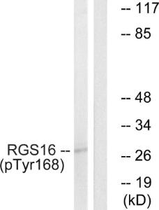 Western blot analysis of lysates from COS7 cells treated with heat shock using Anti-RGS16 (phospho Tyr168) Antibody The right hand lane represents a negative control, where the antibody is blocked by the immunising peptide