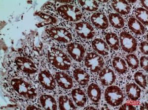 Immunohistochemical analysis of paraffin-embedded human colon using Anti-PROC Antibody