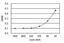 Anti-L3MBTL4 Antibody Pair