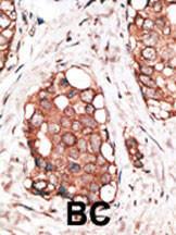 Anti-HPCAL1 Rabbit Polyclonal Antibody (AP (Alkaline Phosphatase))