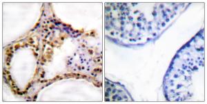 Immunohistochemical analysis of paraffin-embedded human testis using Anti-RAD52 (phospho Tyr104) Antibody. The right hand panel represents a negative control, where the antibody was pre-incubated with the immunising peptide