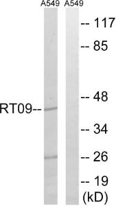 Western blot analysis of lysates from A549 cells using Anti-MRPS9 Antibody. The right hand lane represents a negative control, where the antibody is blocked by the immunising peptide.