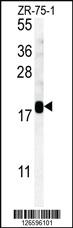 Anti-SDHAF1 Rabbit Polyclonal Antibody