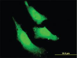 Anti-RNF111 Mouse Monoclonal Antibody [clone: 1C4]