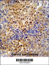 Anti-PR38A Rabbit Polyclonal Antibody (Biotin)