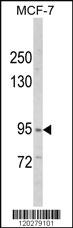 Anti-VPS53 Rabbit Polyclonal Antibody