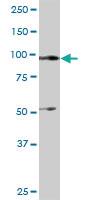 Anti-ITGB2 Rabbit Polyclonal Antibody