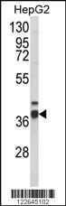 Anti-ECI2 Rabbit Polyclonal Antibody (Biotin)