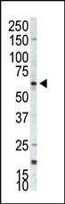 Anti-RPS6KB2 Rabbit Polyclonal Antibody (AP (Alkaline Phosphatase))