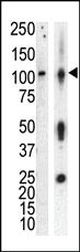 Anti-PRKD3 Rabbit Polyclonal Antibody