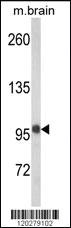 Anti-VPS53 Rabbit Polyclonal Antibody