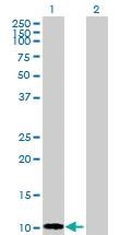 Anti-B2M Rabbit Polyclonal Antibody