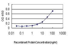 Anti-ITGB2 Mouse Monoclonal Antibody [clone: 5F12]