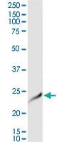 Anti-SENP8 Polyclonal Antibody Pair