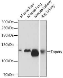 Western blot analysis of extracts of various cell lines, using Anti-p53 BP3 Antibody (A308125) at 1:1000 dilution. The secondary Antibody was Goat Anti-Rabbit IgG H&L Antibody (HRP) at 1:10000 dilution. Lysates/proteins were present at 25 µg per lane