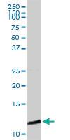 Anti-B2M Rabbit Polyclonal Antibody