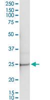 Anti-SENP8 Antibody Pair