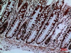 Immunohistochemical analysis of paraffin-embedded human colon using Anti-PROC Antibody