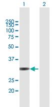 Anti-UNKL Mouse Polyclonal Antibody