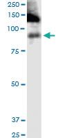 Anti-ITGB2 Mouse Monoclonal Antibody [clone: 3C7]