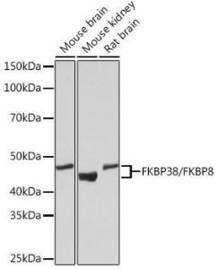 Western blot analysis of extracts of various cell lines, using Anti-FKBP38 Antibody [ARC1259] (A307004) at 1:1000 dilution