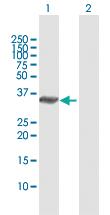 Anti-SPRY1 Rabbit Polyclonal Antibody