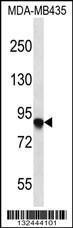 Anti-AFAP1 Rabbit Polyclonal Antibody (FITC (Fluorescein Isothiocyanate))