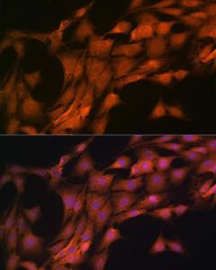 Immunofluorescence analysis of C6 cells using Anti-FKBP38 Antibody [ARC1259] (A307004) at a dilution of 1:100 (40x lens). DAPI was used to stain the cell nuclei (blue)