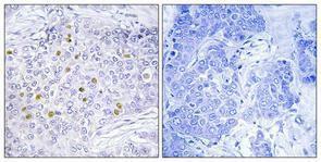 Anti-GCN5L2 antibody